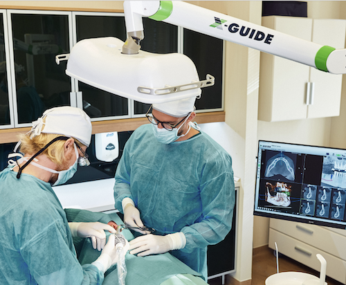 Technologie Xguide pour implants dentaires